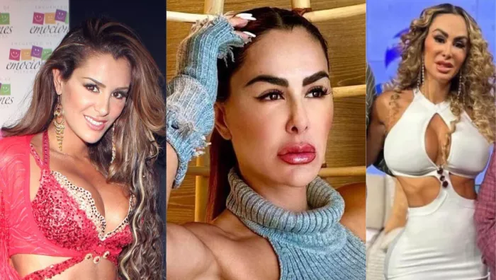 ninel conde antes y despues