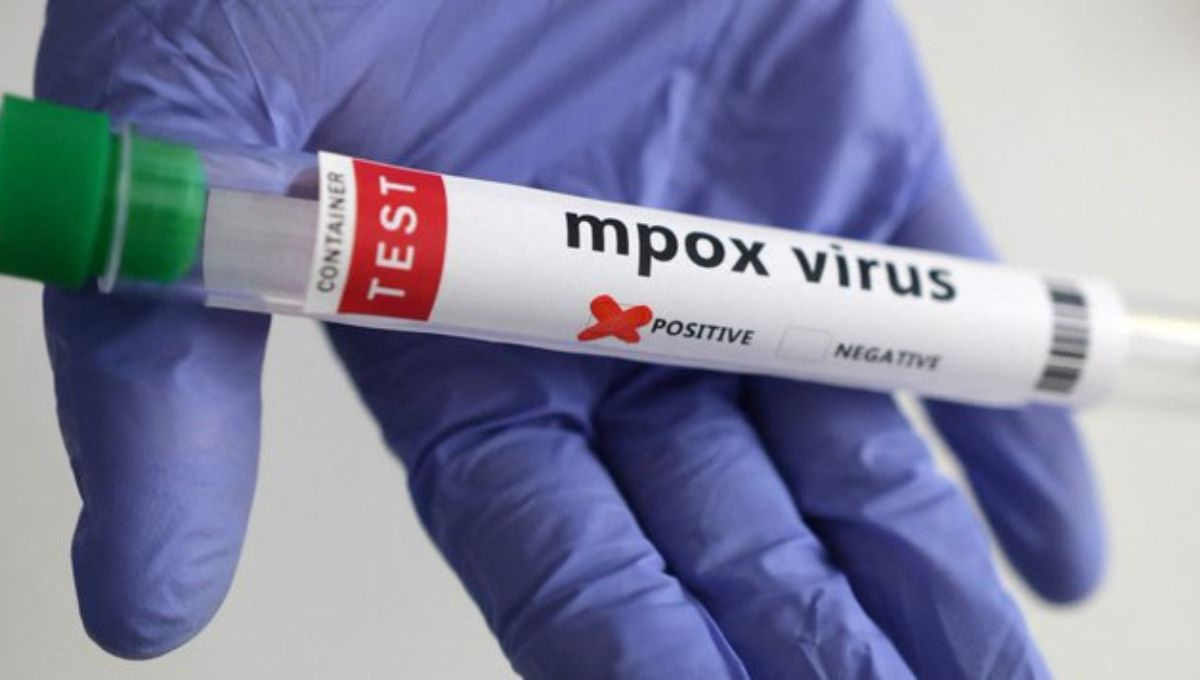 OMS aprueba la primera prueba de diagnóstico de mpox para uso de emergencia