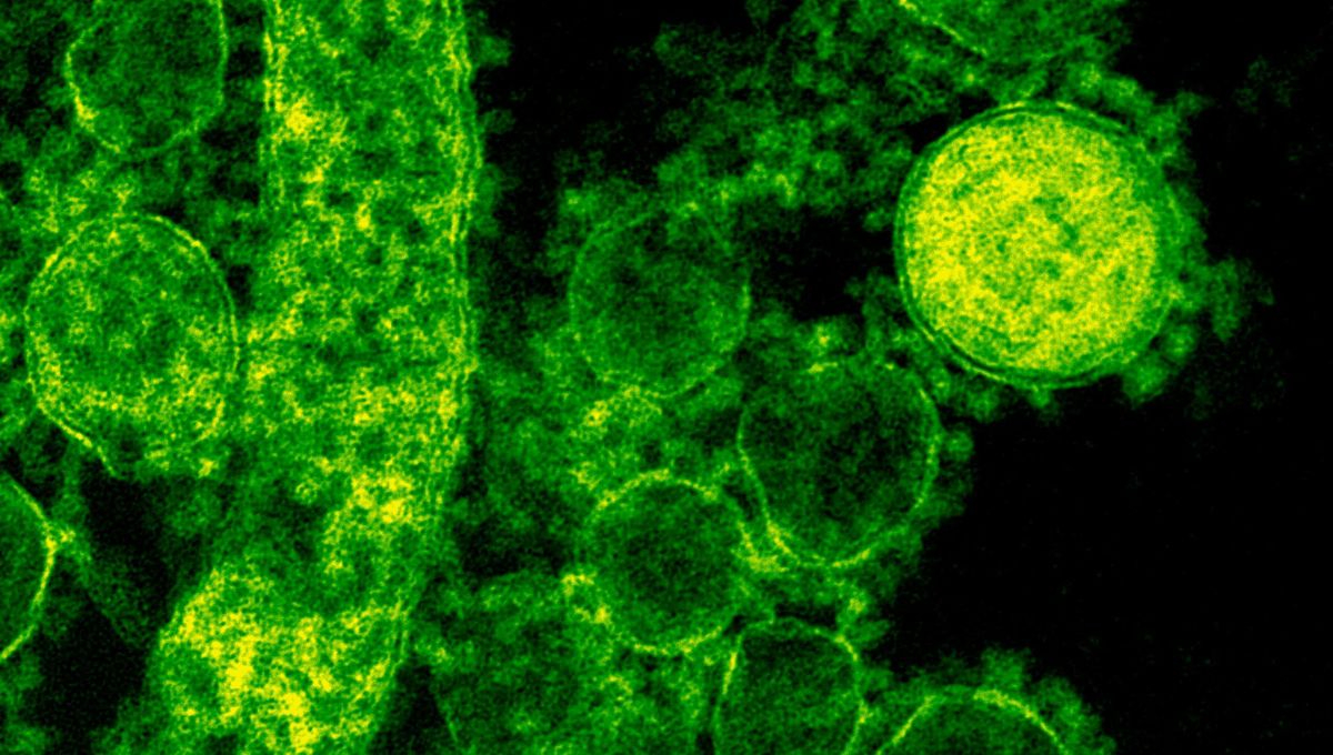 ¿Cuáles son los 10 principales síntomas de la bacteria Klebsiella Oxytoca?