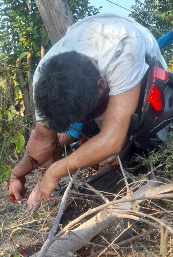 Paramédicos no pudieron salvar la vida del hombre en Campeche