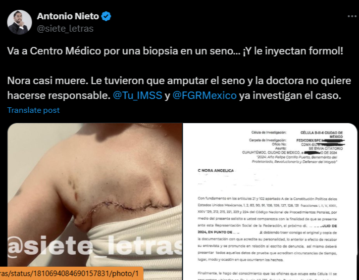 Mujer denuncia negligencia médica luego de que le amputaron el seno / Web