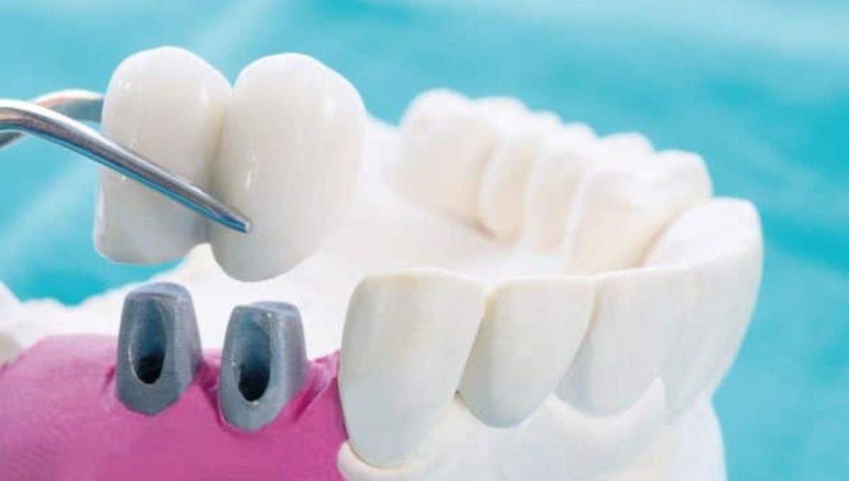 Empresa china habría robado alrededor de cuatro mil cadáveres de crematorios para fabricar prótesis dentales