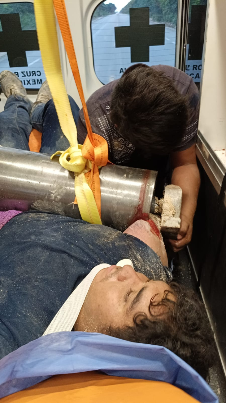 Trabajador del Tren Maya accidenta su brazo dentro de una trituradora de piedras.