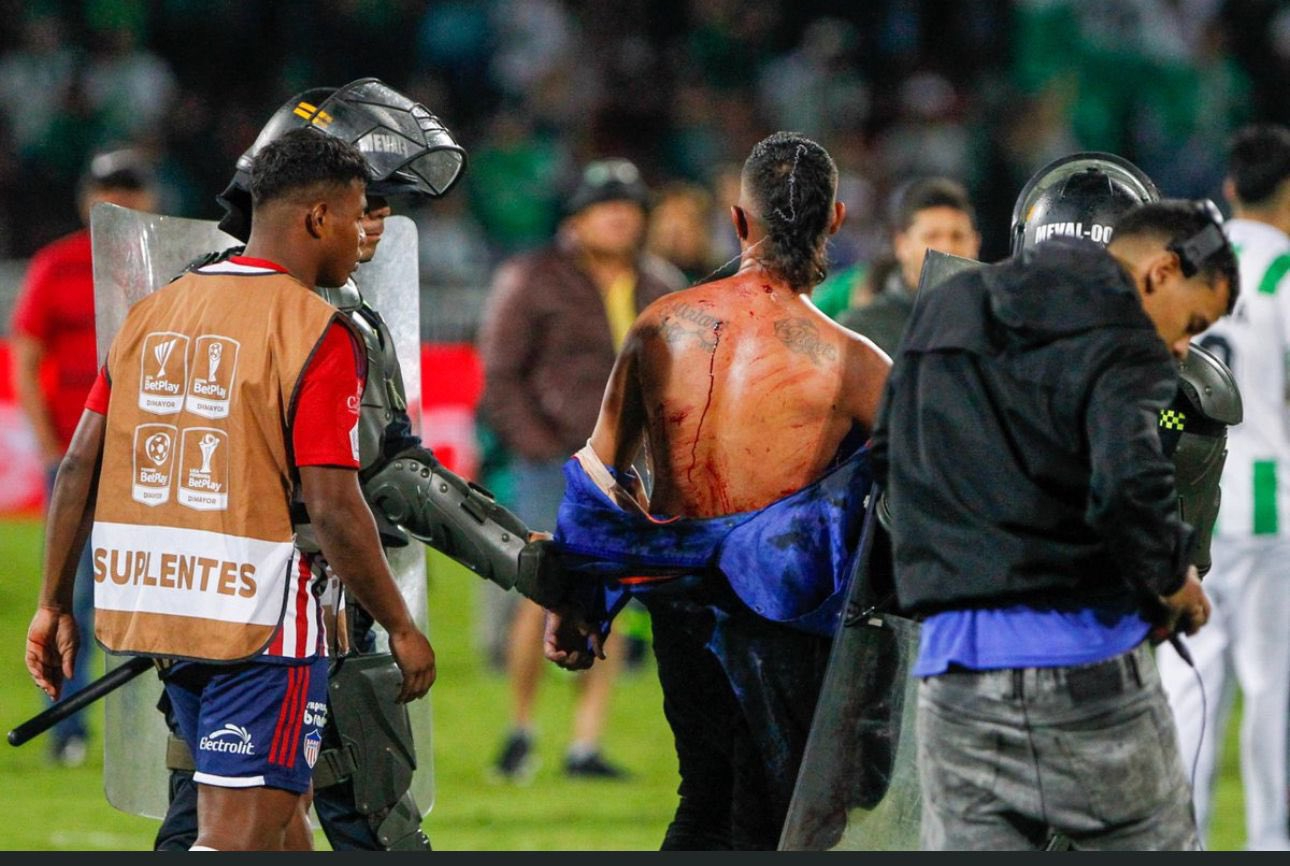 Violencia en el futbol colombiano: 21 heridos en partido Atlético Nacional vs. Junior