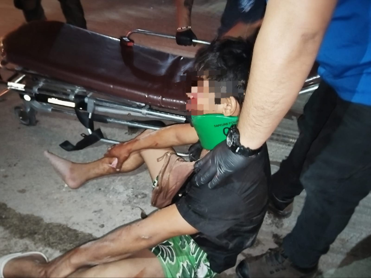 Joven sufre accidente en su motocicleta en Chetumal debido a un bache  