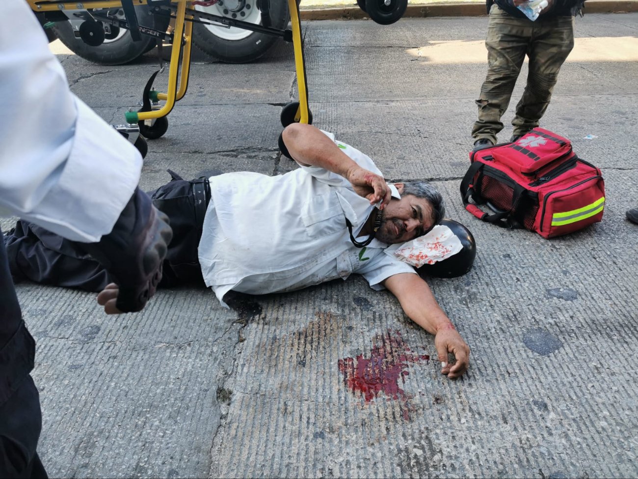 El adulto mayor presentó una herida en el cráneo.