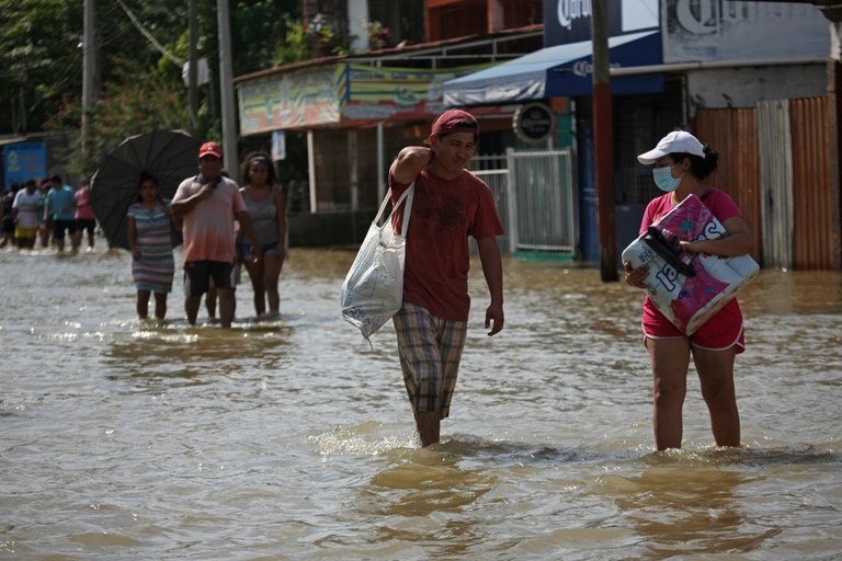 Pies se les pudren por inundaciones en Tabasco