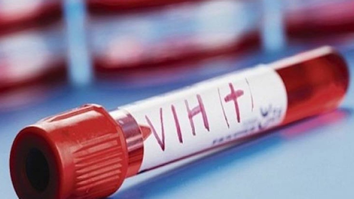 Campeche ha registrado 4,607 casos de VIH en 38 años; el más bajo en la Península de Yucatán