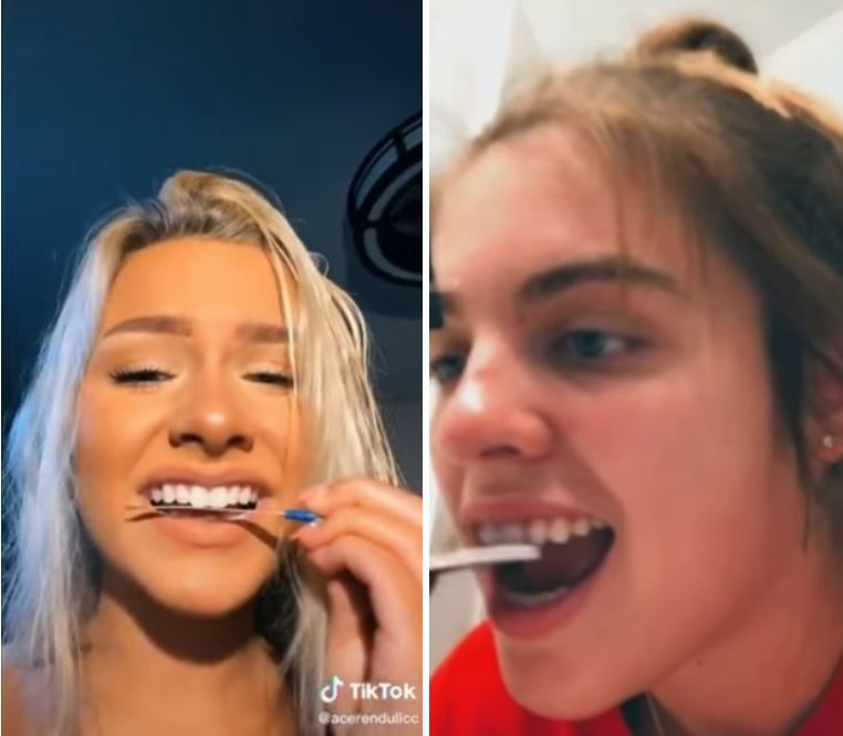 TikTok: Especialistas alertan por tendencia de limar los dientes para conseguir una dentadura perfecta