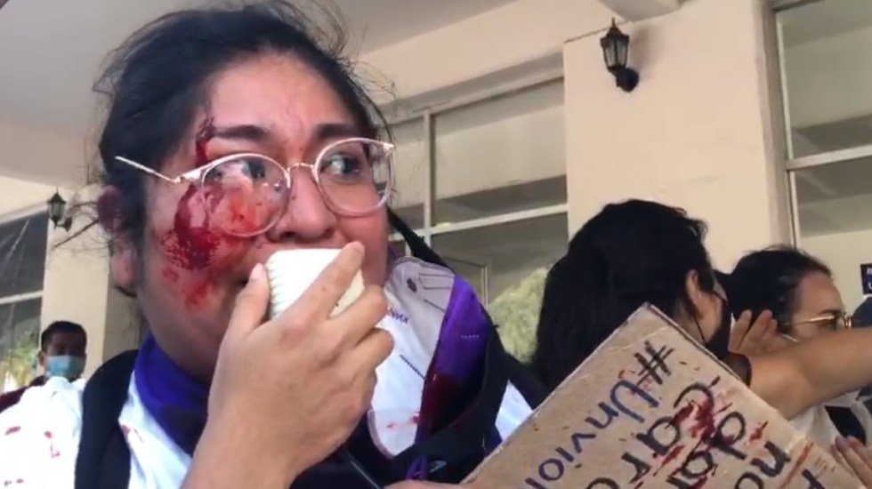 La activista feminista fue agredida durante una trifulca