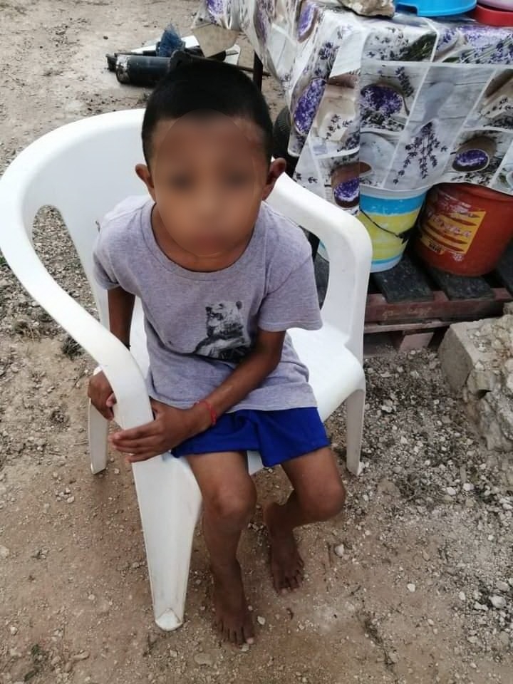 Niño escapa de su casa por maltrato en Kanasín