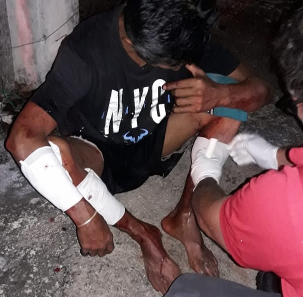 Perros atacan a hombre que intentó robar una casa en Cozumel
