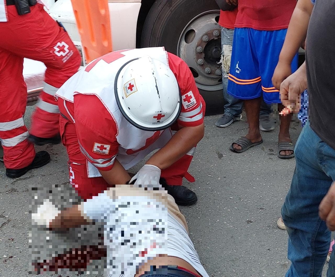 Amputan dedo a motociclista tras choque en Ciudad del Carmen