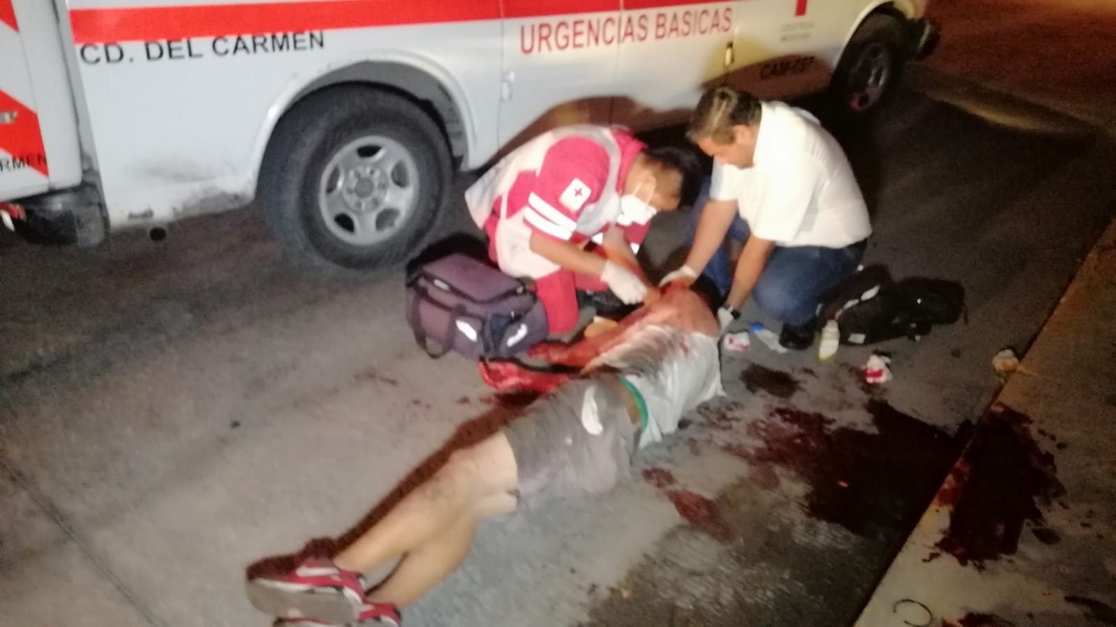 Hombre sufre fuerte golpiza al resistirse a un asalto en Ciudad del Carmen