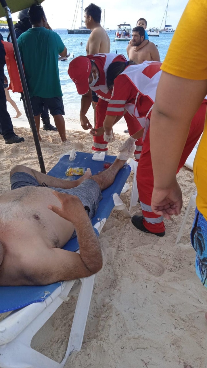 Este visitante perdió el meñique derecho y se lesionó el siguiente dedo al ser prensado entre la moto y el bote