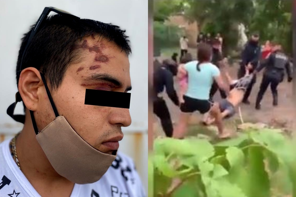 El agraviado mostró los moretones y heridas en su cuerpo tras la golpiza dada por policías estatales en Cancún