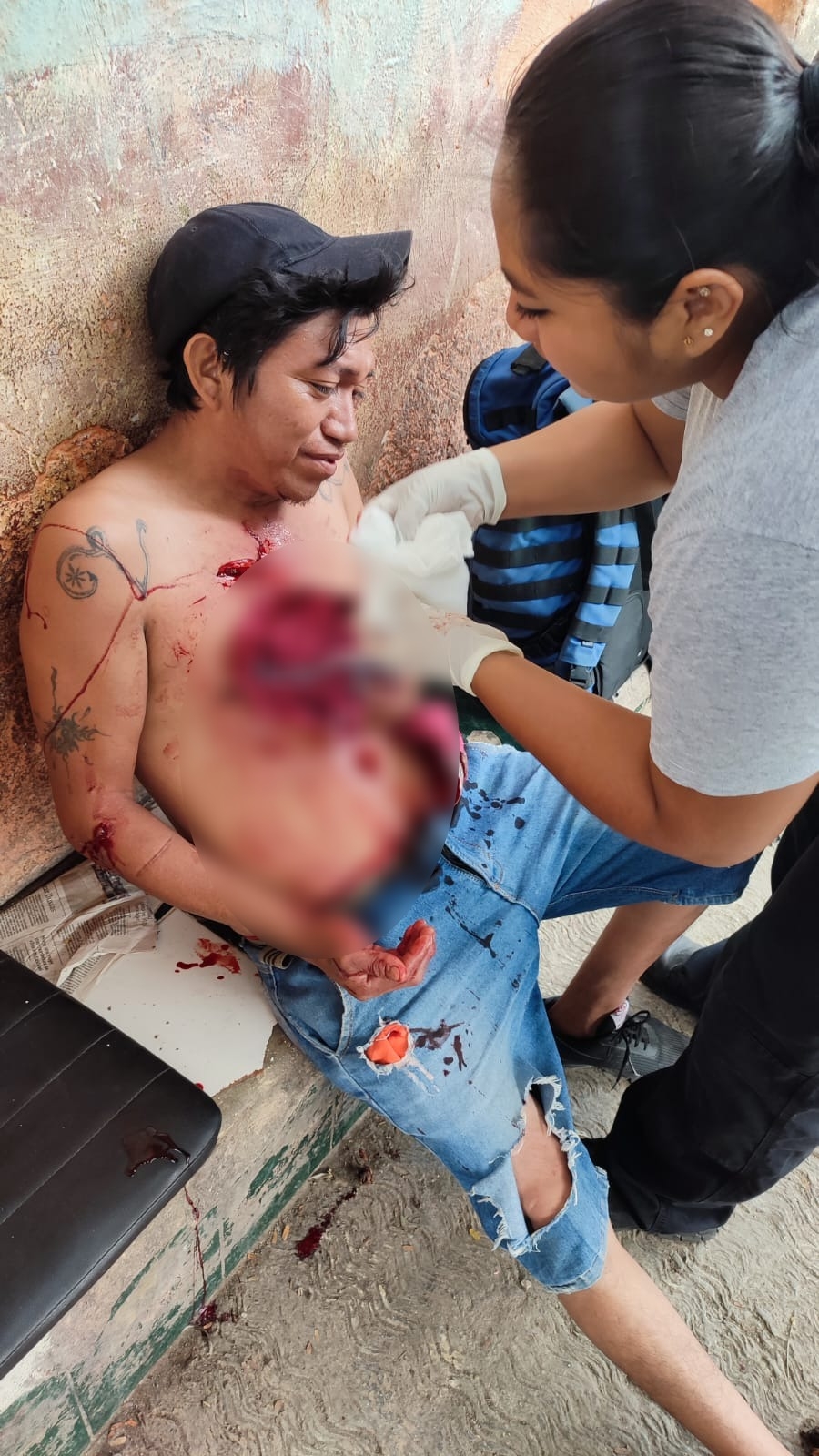 El hombre tuvo que ser trasladado al Hospital General de Chetumal