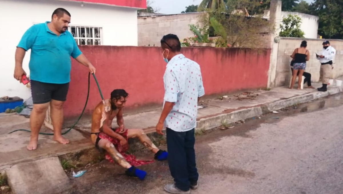 Paramédicos de Umán trasladaron a un hombre al hospital, con quemaduras de la cabeza hasta la cintura