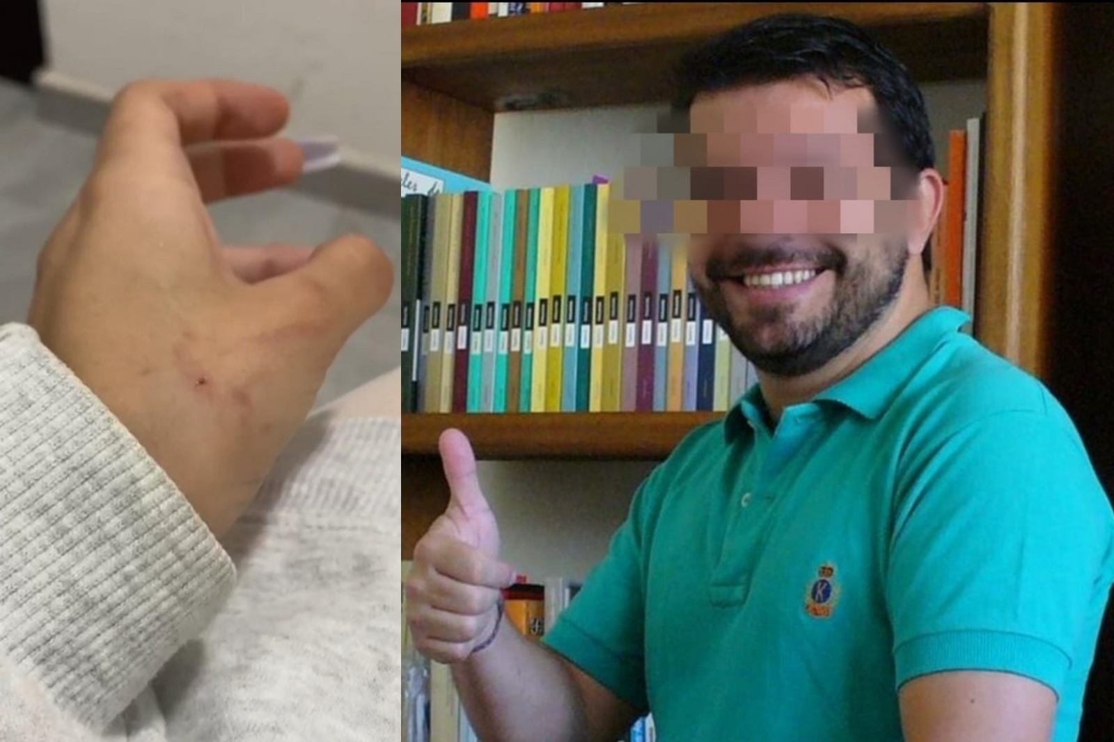 Me golpeó y me mordió: Víctima del profesor colombiano en Chetumal narra los hechos