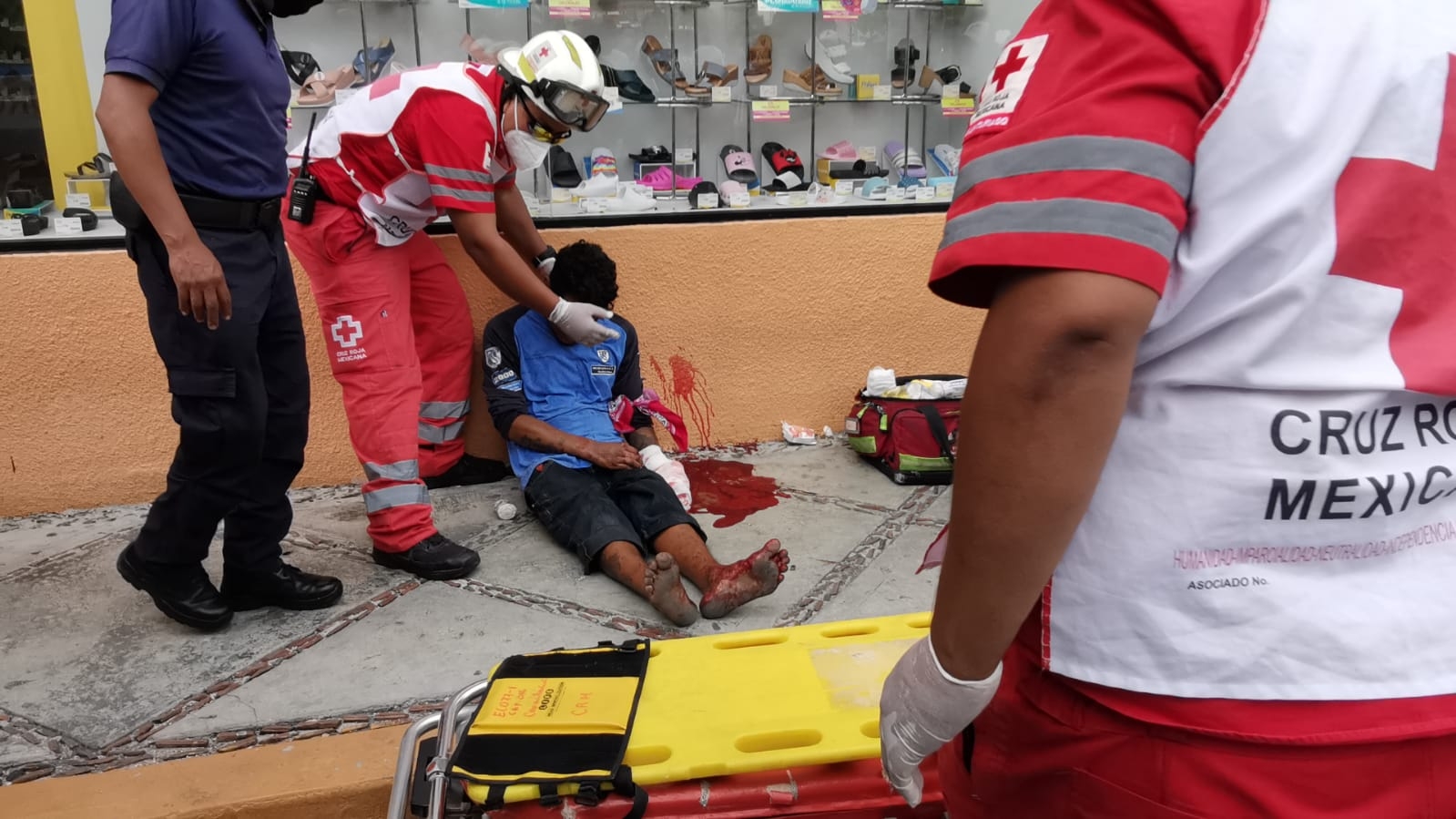 Riña en un bar deja a un hombre con una grave herida en el brazo en Ciudad del Carmen