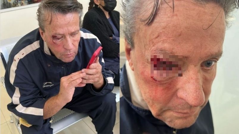 Alfredo Adame recibe fuerte golpiza afuera de su casa; así quedó: FOTO