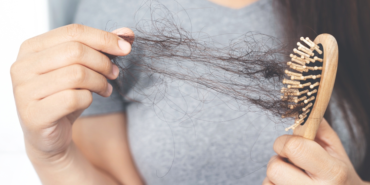 La alopecia no es un tema solo de hombres. Foto: Especial.