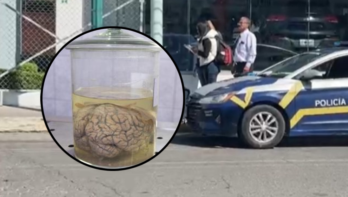 El cerebro se encontraba dentro de un frasco junto a un poste en Toluca