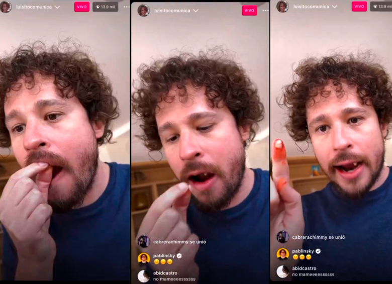 Luisito Comunica explicó a sus seguidores el motivo de que haya perdido sus dientes