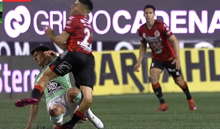 Carlos Valenzuela, futbolista de Xolos, sufrió una escalofriante lesión en el partido contra León disputado en el Estadio Caliente.