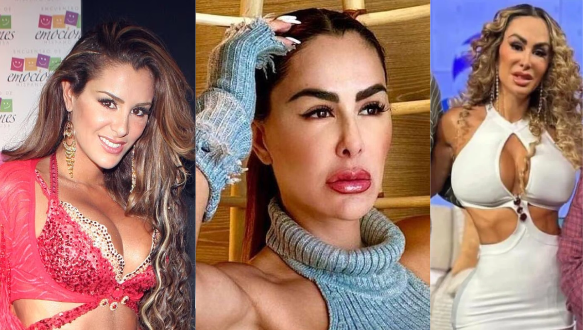 ¿Ninel Conde se mete cuchillo, otra vez? luce rostro irreconocible e inflamado: FOTO