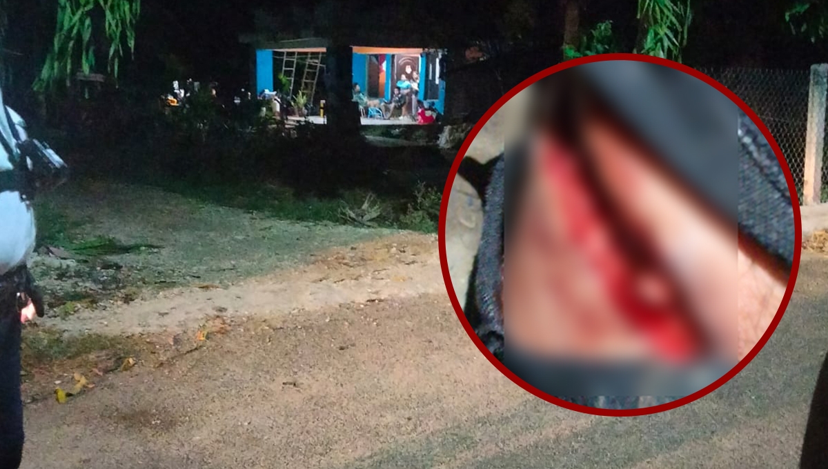 Conductor ebrio atropella a un motociclista en Tenabo, Campeche